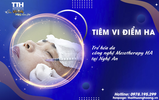Tiêm vi điểm HA là gì? Trẻ hóa da công nghệ Mesotherapy HA tại Nghệ An